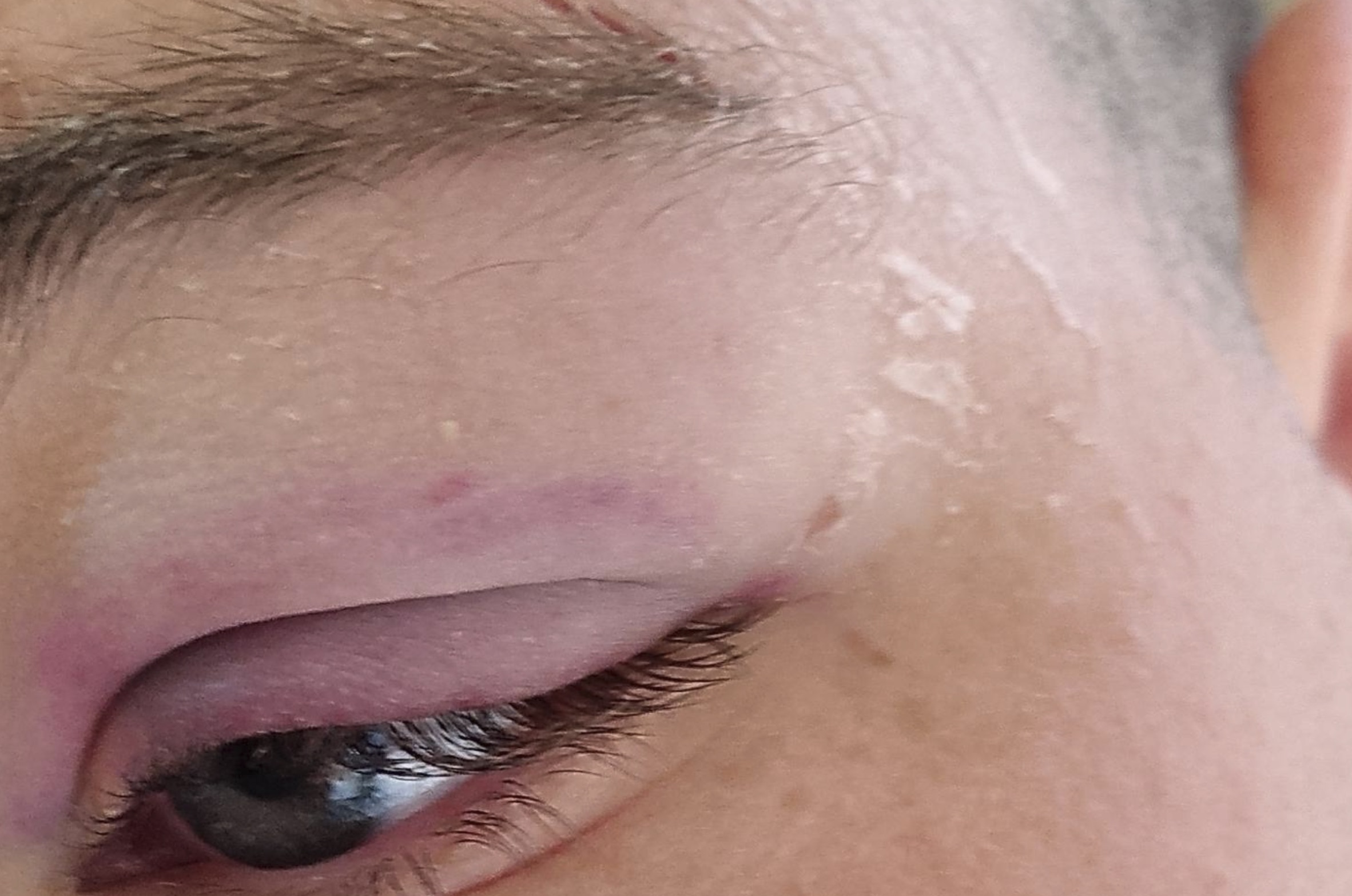 giovane aggredito piazza carlo iii violenza borrelli